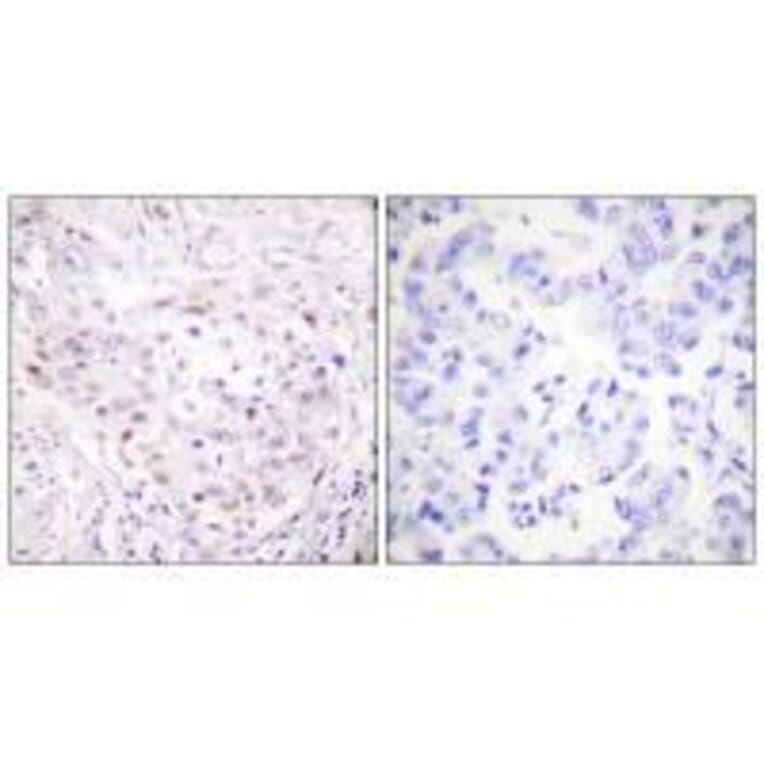 Immunohistochemistry - SENP3 Antibody from Signalway Antibody (33520) - Antibodies.com