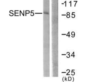 Western blot - SENP5 Antibody from Signalway Antibody (33521) - Antibodies.com