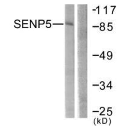 Western blot - SENP5 Antibody from Signalway Antibody (33521) - Antibodies.com