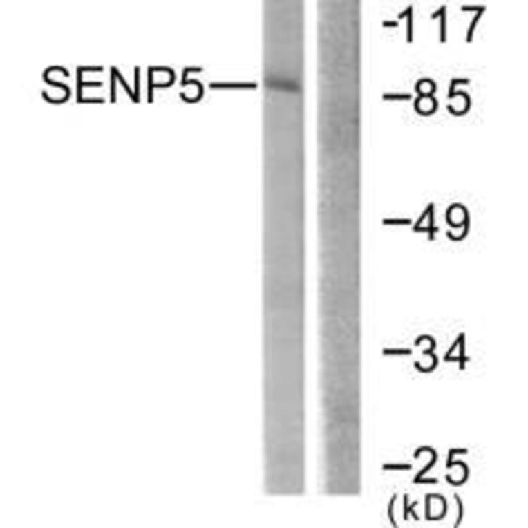 Western blot - SENP5 Antibody from Signalway Antibody (33521) - Antibodies.com