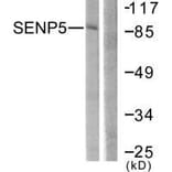 Western blot - SENP5 Antibody from Signalway Antibody (33521) - Antibodies.com