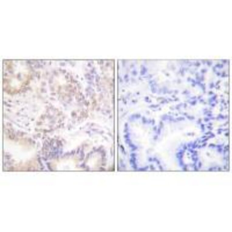 Immunohistochemistry - SENP5 Antibody from Signalway Antibody (33521) - Antibodies.com