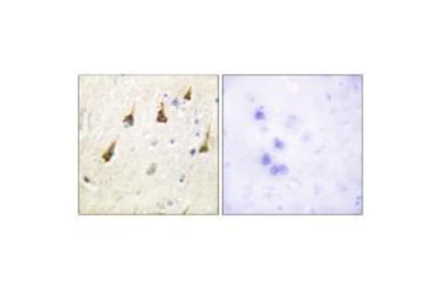 Immunohistochemistry - SENP7 Antibody from Signalway Antibody (33523) - Antibodies.com