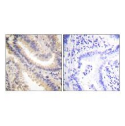 Immunohistochemistry - TIMP4 Antibody from Signalway Antibody (33526) - Antibodies.com