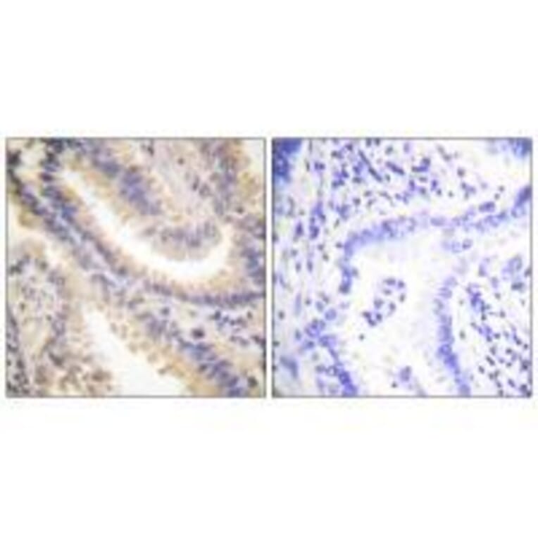 Immunohistochemistry - TIMP4 Antibody from Signalway Antibody (33526) - Antibodies.com