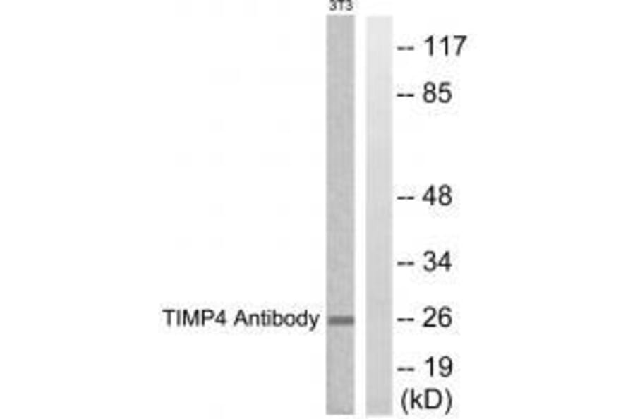 Western blot - TIMP4 Antibody from Signalway Antibody (33526) - Antibodies.com