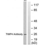 Western blot - TIMP4 Antibody from Signalway Antibody (33526) - Antibodies.com