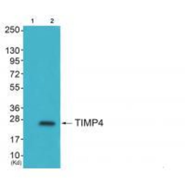 Western blot - TIMP4 Antibody from Signalway Antibody (33526) - Antibodies.com