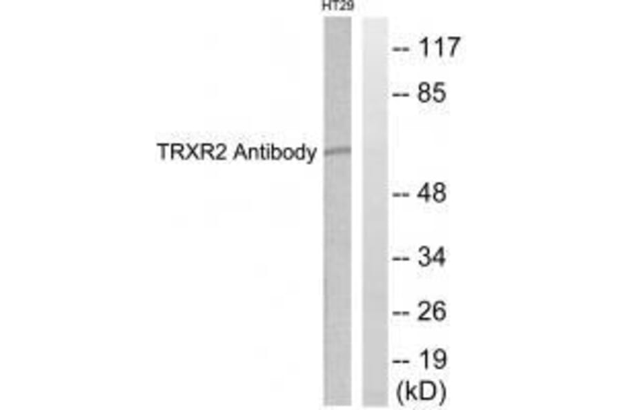 Western blot - TRXR2 Antibody from Signalway Antibody (33530) - Antibodies.com