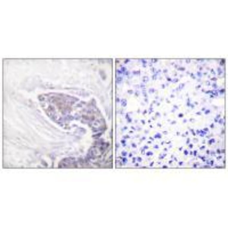Immunohistochemistry - TRXR2 Antibody from Signalway Antibody (33530) - Antibodies.com