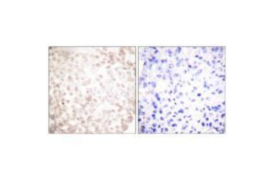 Immunohistochemistry - XRCC1 Antibody from Signalway Antibody (33546) - Antibodies.com