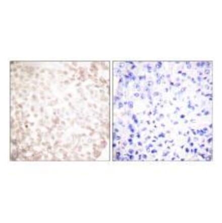 Immunohistochemistry - XRCC1 Antibody from Signalway Antibody (33546) - Antibodies.com