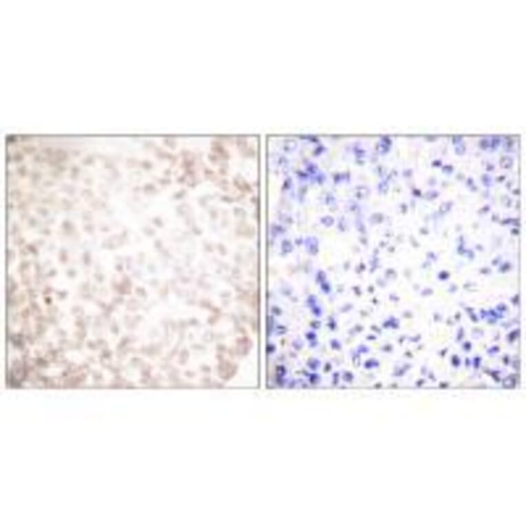 Immunohistochemistry - XRCC1 Antibody from Signalway Antibody (33546) - Antibodies.com