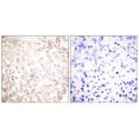 Immunohistochemistry - XRCC1 Antibody from Signalway Antibody (33546) - Antibodies.com