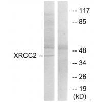 Western blot analysis of extracts from 293cells, using XRCC2 antibody #33547.