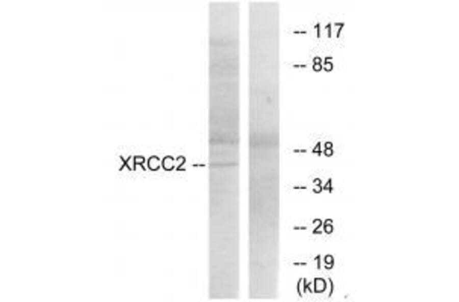 Western blot - XRCC2 Antibody from Signalway Antibody (33547) - Antibodies.com