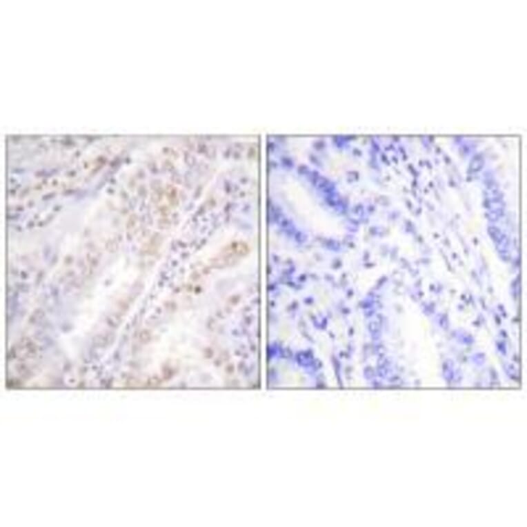 Immunohistochemistry - XRCC2 Antibody from Signalway Antibody (33547) - Antibodies.com