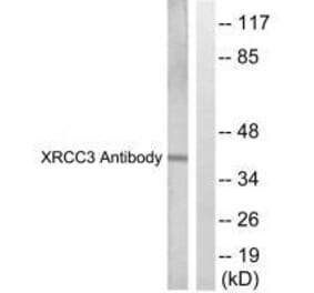 Western blot - XRCC3 Antibody from Signalway Antibody (33548) - Antibodies.com