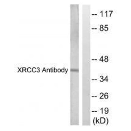 Western blot - XRCC3 Antibody from Signalway Antibody (33548) - Antibodies.com
