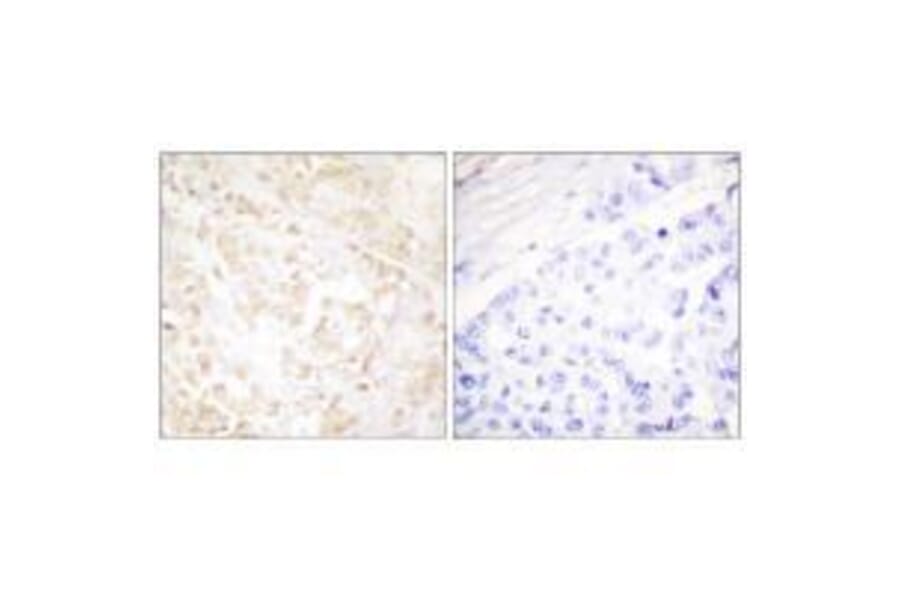 Immunohistochemistry - XRCC6 Antibody from Signalway Antibody (33551) - Antibodies.com