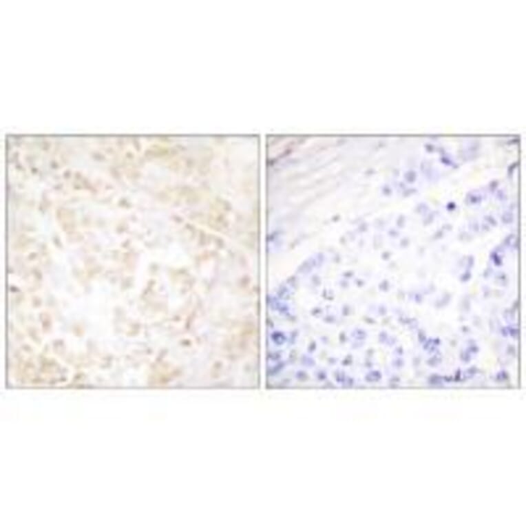 Immunohistochemistry - XRCC6 Antibody from Signalway Antibody (33551) - Antibodies.com