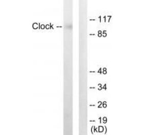 Western blot - Clock Antibody from Signalway Antibody (33580) - Antibodies.com