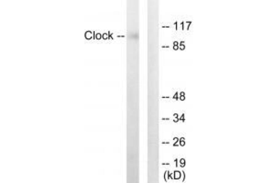 Western blot - Clock Antibody from Signalway Antibody (33580) - Antibodies.com