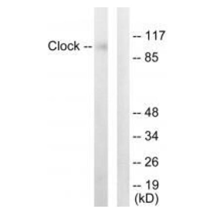 Western blot - Clock Antibody from Signalway Antibody (33580) - Antibodies.com