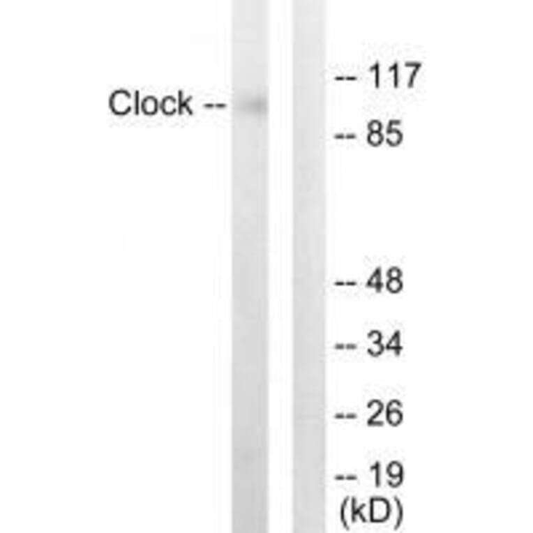Western blot - Clock Antibody from Signalway Antibody (33580) - Antibodies.com