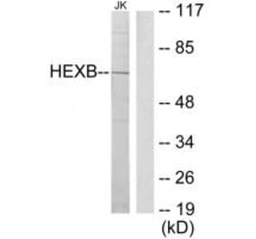Western blot - HEXB Antibody from Signalway Antibody (33657) - Antibodies.com