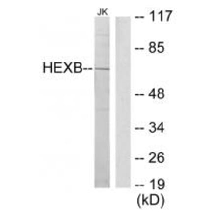 Western blot - HEXB Antibody from Signalway Antibody (33657) - Antibodies.com