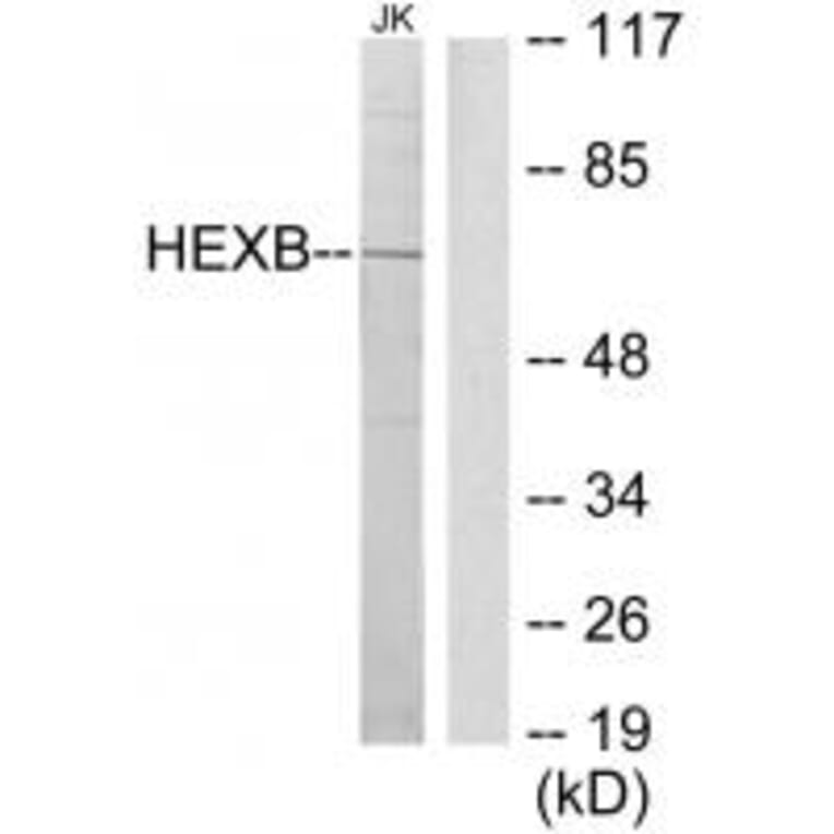 Western blot - HEXB Antibody from Signalway Antibody (33657) - Antibodies.com