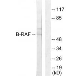 Western blot - B-RAF Antibody from Signalway Antibody (33683) - Antibodies.com