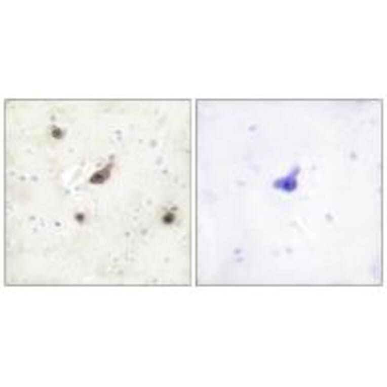 Immunohistochemistry - B-RAF Antibody from Signalway Antibody (33683) - Antibodies.com