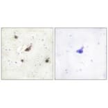 Immunohistochemistry - B-RAF Antibody from Signalway Antibody (33683) - Antibodies.com