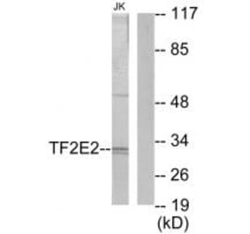 Western blot - TF2E2 Antibody from Signalway Antibody (33739) - Antibodies.com