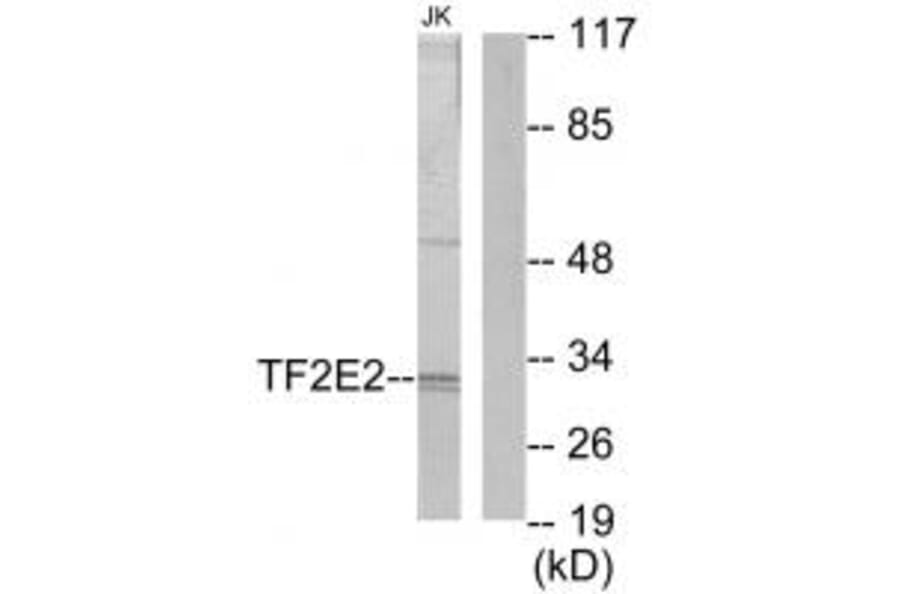 Western blot - TF2E2 Antibody from Signalway Antibody (33739) - Antibodies.com