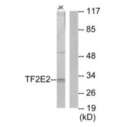 Western blot - TF2E2 Antibody from Signalway Antibody (33739) - Antibodies.com