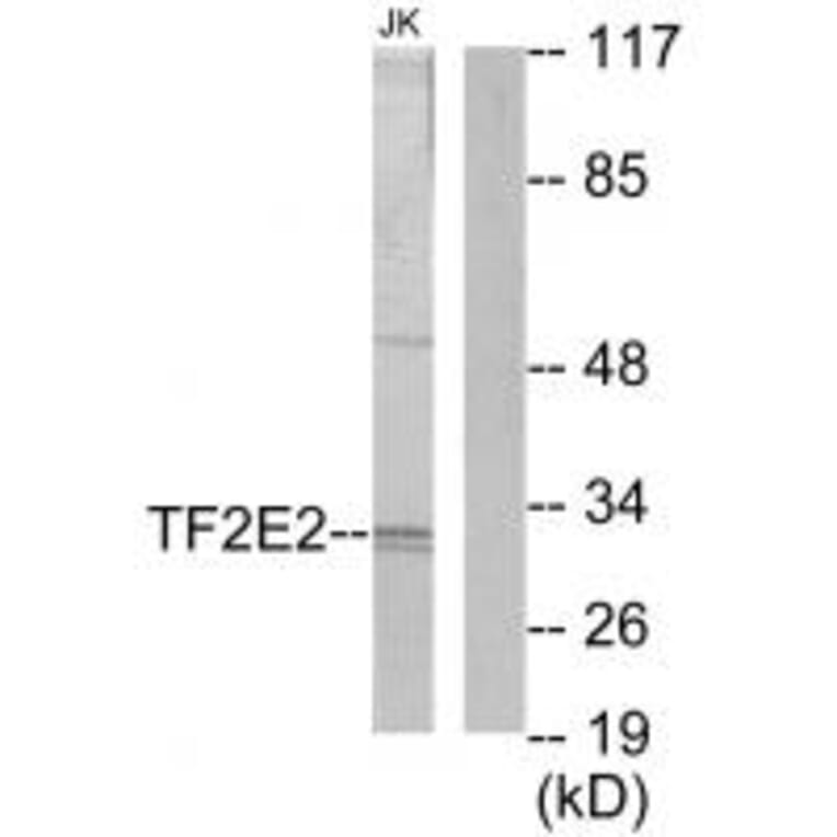 Western blot - TF2E2 Antibody from Signalway Antibody (33739) - Antibodies.com