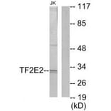 Western blot - TF2E2 Antibody from Signalway Antibody (33739) - Antibodies.com