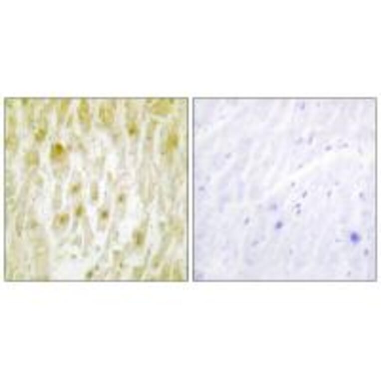 Immunohistochemistry - TF2E2 Antibody from Signalway Antibody (33739) - Antibodies.com