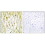 Immunohistochemistry - TF2E2 Antibody from Signalway Antibody (33739) - Antibodies.com