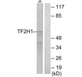 Western blot - TF2H1 Antibody from Signalway Antibody (33751) - Antibodies.com