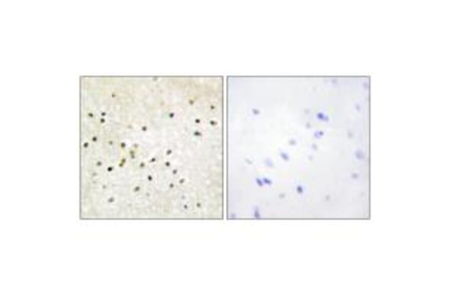 Immunohistochemistry - TF2H1 Antibody from Signalway Antibody (33751) - Antibodies.com
