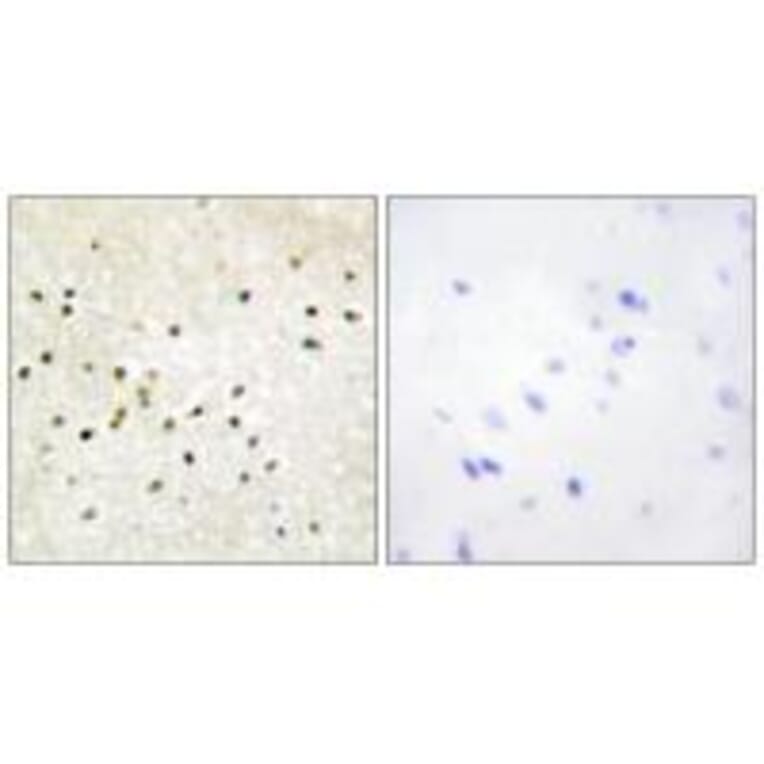 Immunohistochemistry - TF2H1 Antibody from Signalway Antibody (33751) - Antibodies.com