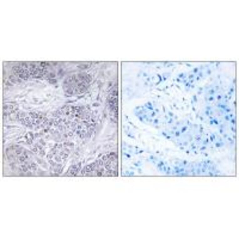 Immunohistochemistry - CEBPG Antibody from Signalway Antibody (33813) - Antibodies.com