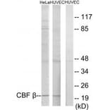 Western blot - CBF β Antibody from Signalway Antibody (33875) - Antibodies.com