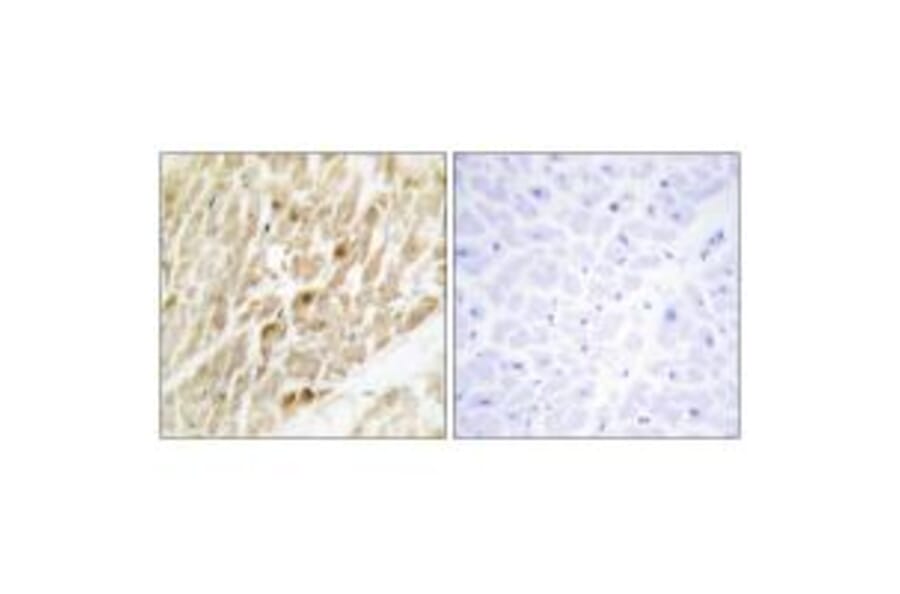 Immunohistochemistry - CBF β Antibody from Signalway Antibody (33875) - Antibodies.com