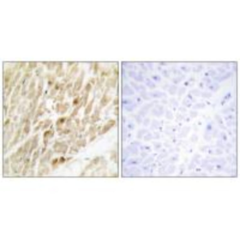 Immunohistochemistry - CBF β Antibody from Signalway Antibody (33875) - Antibodies.com