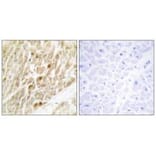 Immunohistochemistry - CBF β Antibody from Signalway Antibody (33875) - Antibodies.com